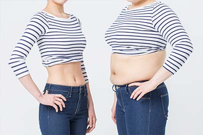 비만1